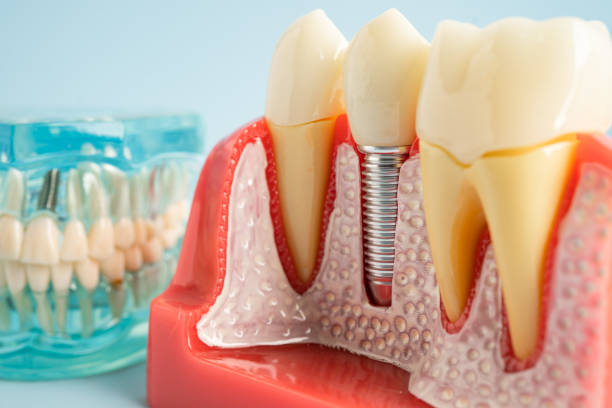 Best Dental Fillings (Composite and Amalgam)  in Melvindale, MI